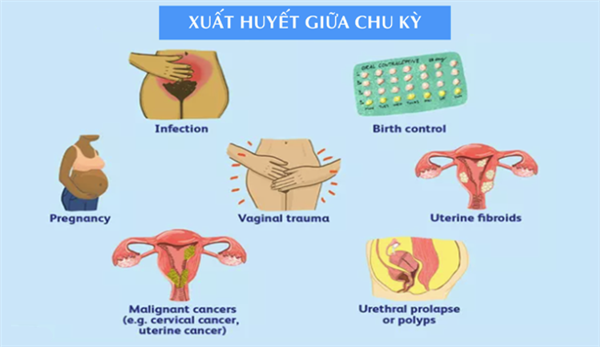 Xuất huyết giữa chu kỳ - Bệnh viện Từ Dũ Xuất huyết giữa chu kỳ - Bệnh viện Từ Dũ